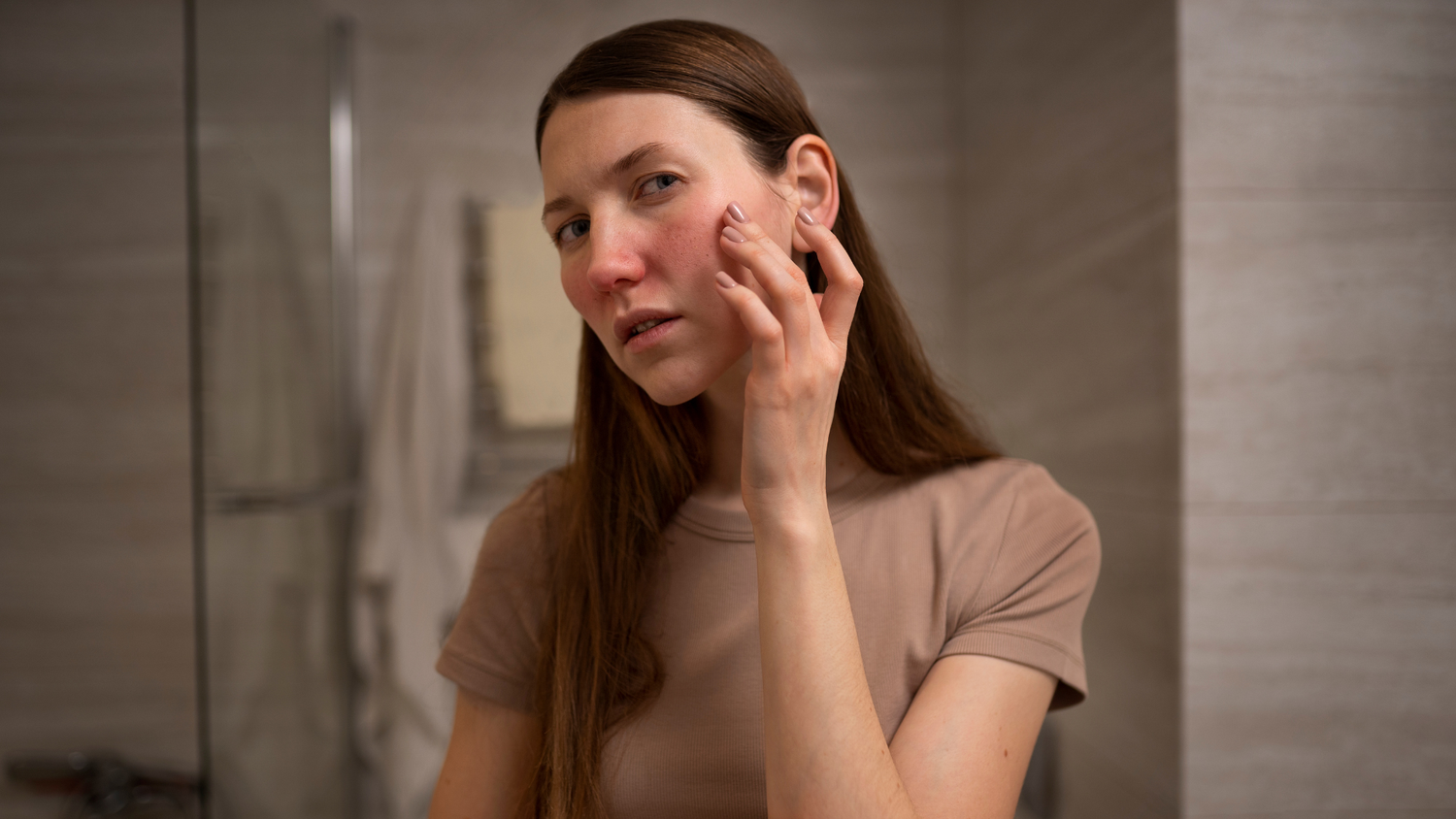 what is acne prone skin