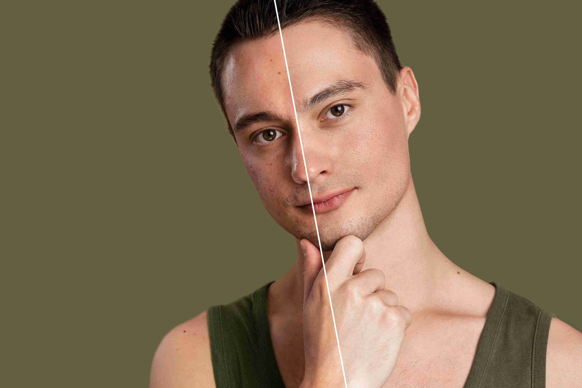 dry skin vs dehydrated skin