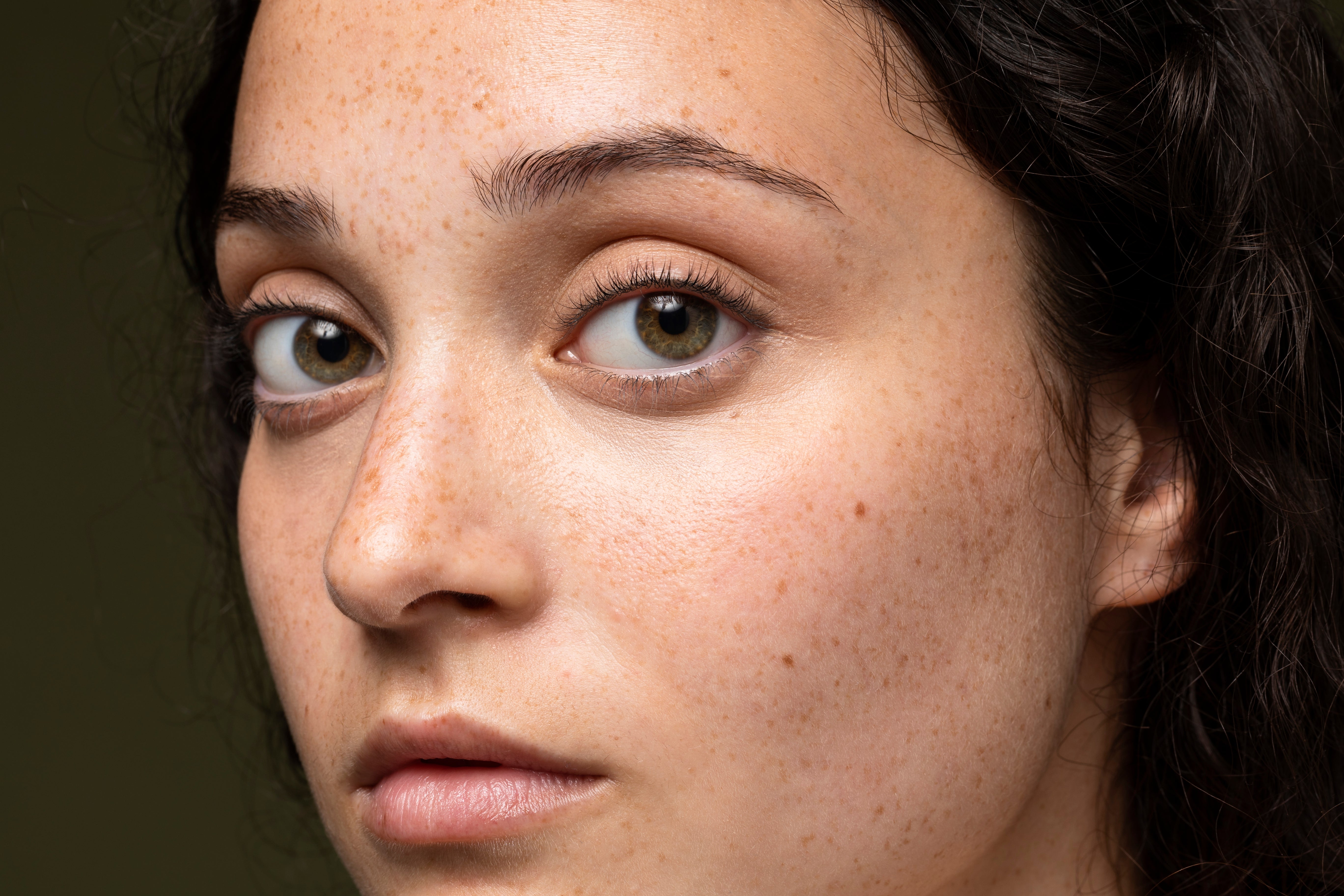 how to reduce pigmentation