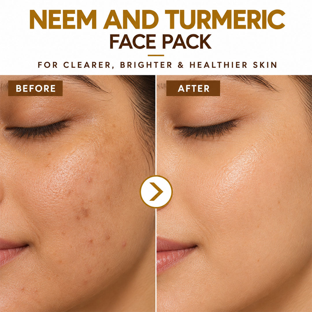Neem & Turmeric Face Pack