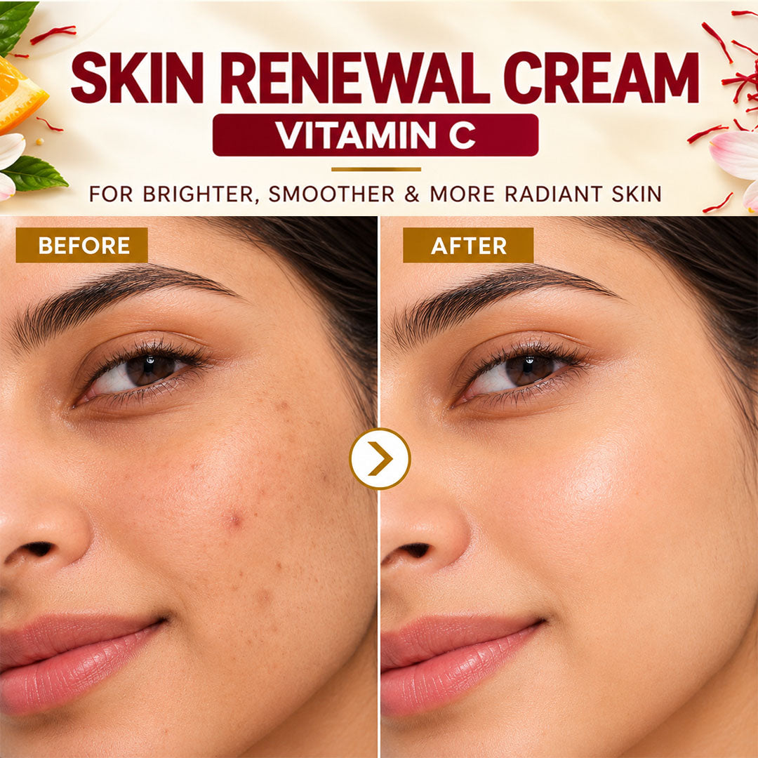 Skin Renewal Cream with Vitamin C - Wildflower Naturals