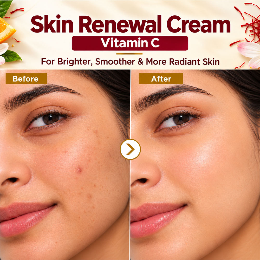 Skin Renewal Cream with Vitamin C - Wildflower Naturals