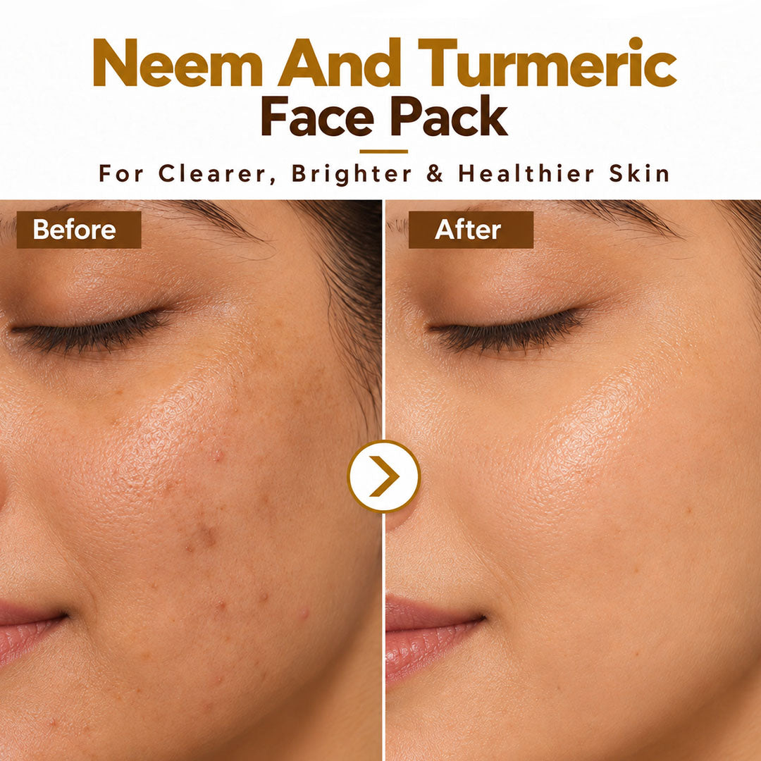 Neem & Turmeric Face Pack